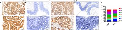 The Chemokine CXCL7 Is Related to Angiogenesis and Associated With Poor Prognosis in Colorectal Cancer Patients